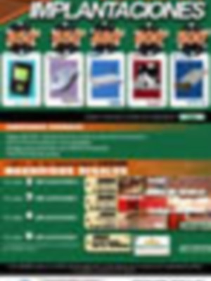 Las implantaciones de Compuspain se convierten en la sensación de las Navidades